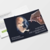 Postkarte "Keine Abtreibungsunion" Motiv 5: Assistierter Suizid – Aktion Lebensrecht für Alle ALfA e.V.